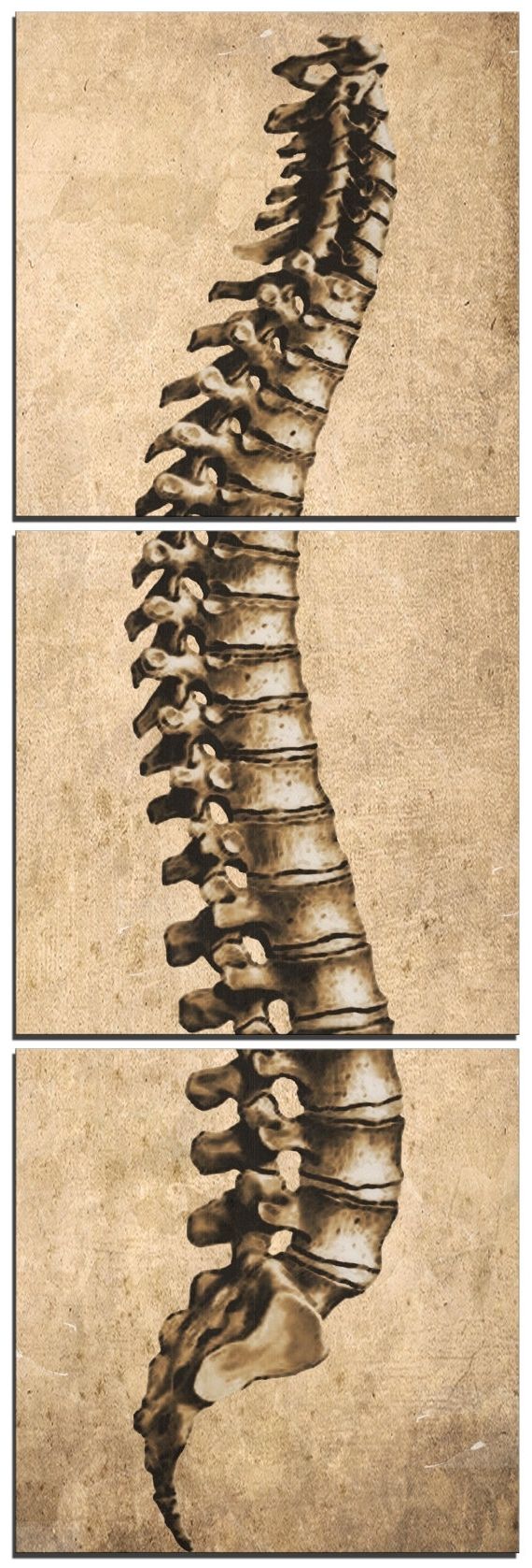 Favorite Chiropractic Wall Art Intended For 12 Spine Canvas Artsouth5thstreetdesign On Etsy, $ (View 8 of 15)